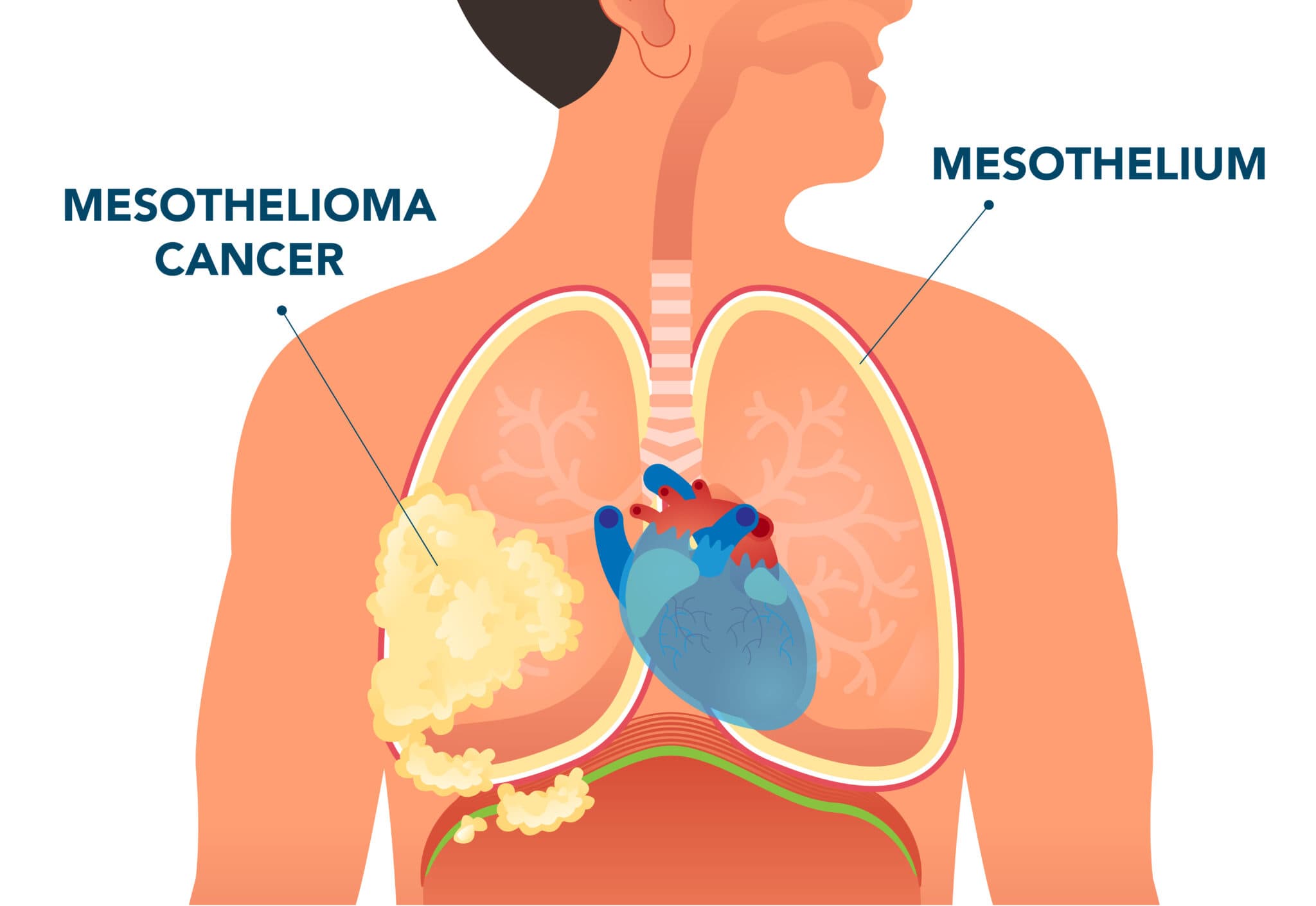 What is mesothelium